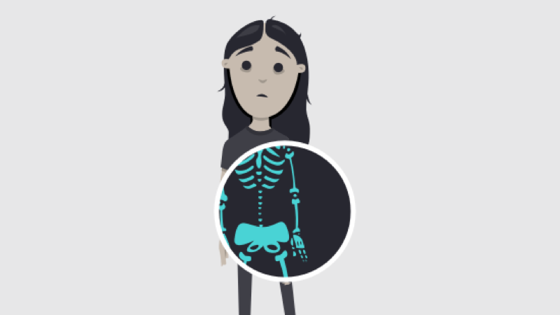 X-ray me - SVG clipping experiment